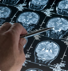 A hand pointing at MRI scans of an infant skull displayed on a screen with a pen.